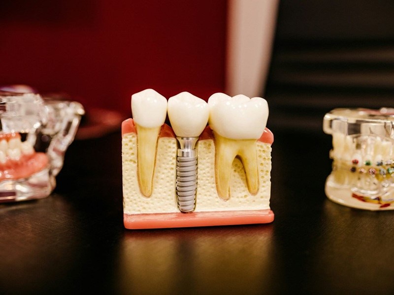 Klein Dental Arts Klein Dental Arts