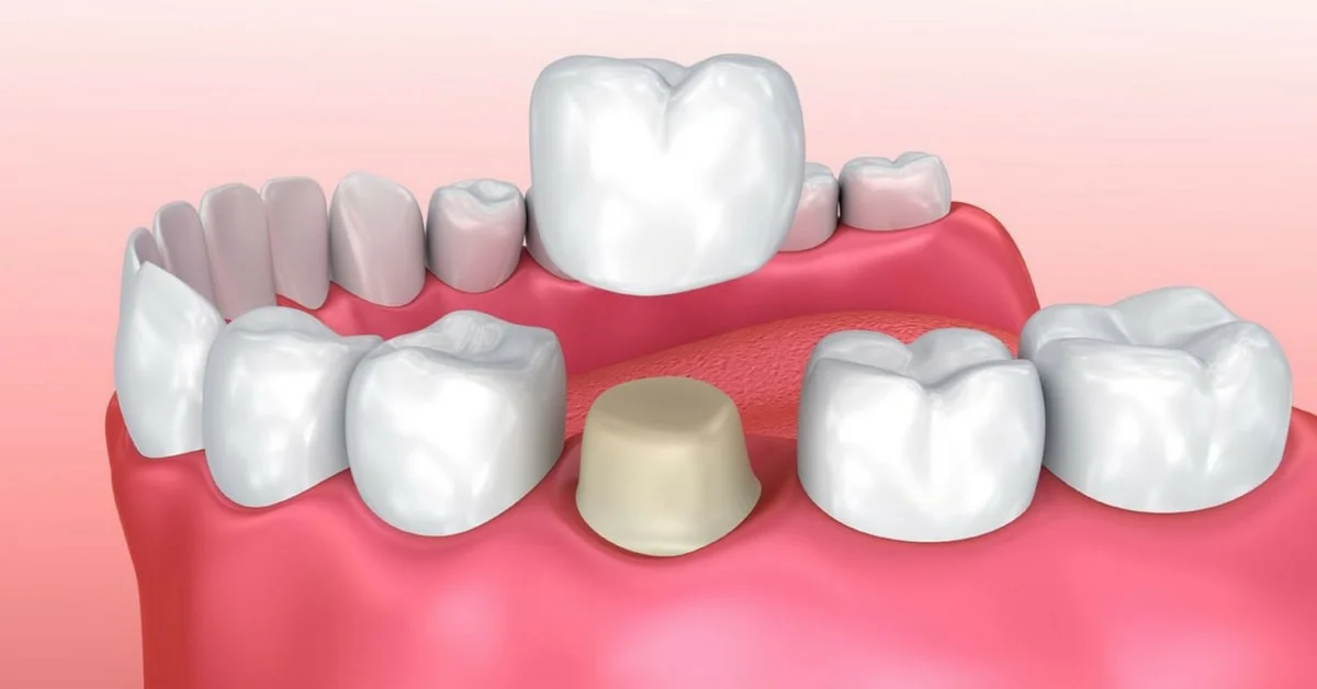 Klein Dental Arts Klein Dental Arts