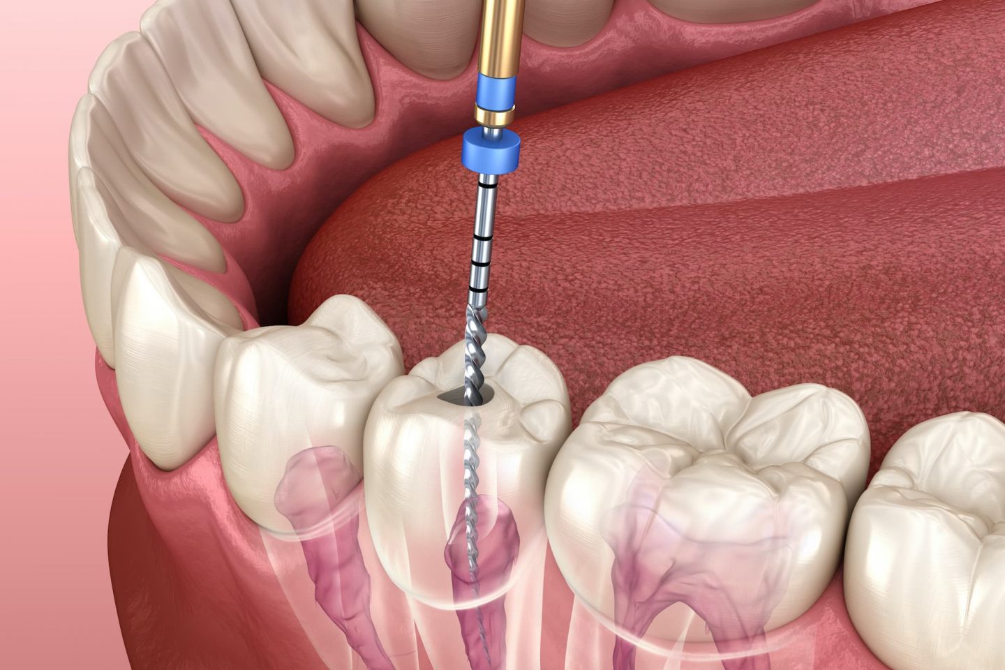 Klein Dental Arts Klein Dental Arts
